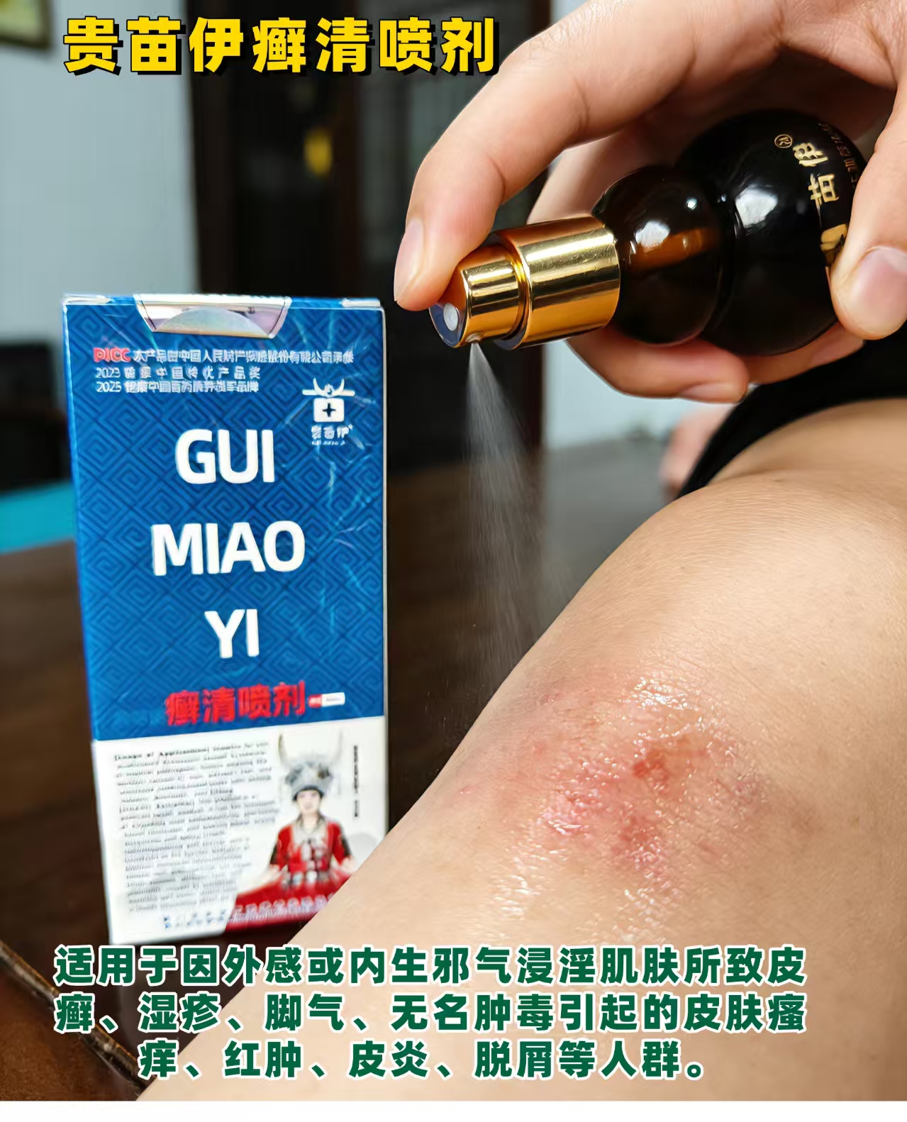 贵苗伊癣清喷剂